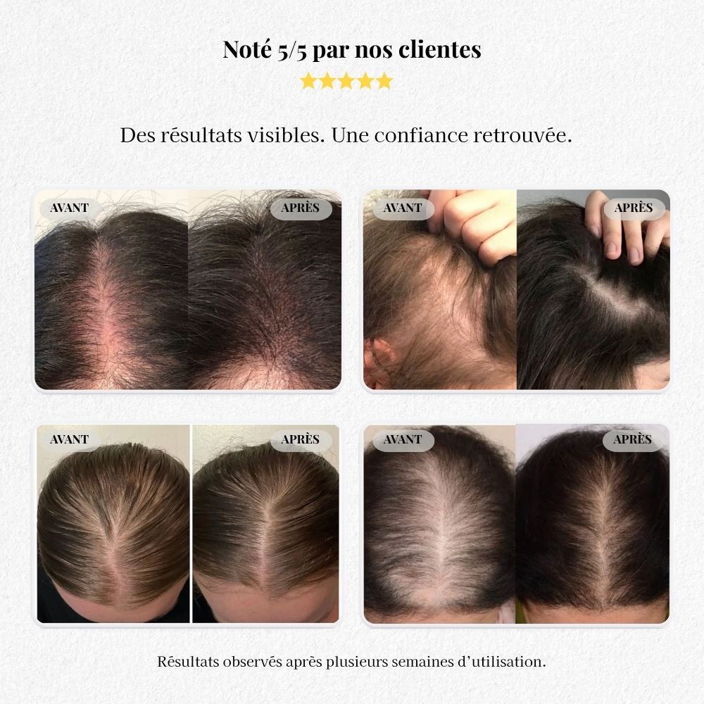 Sérum Fortifiant au Gingembre